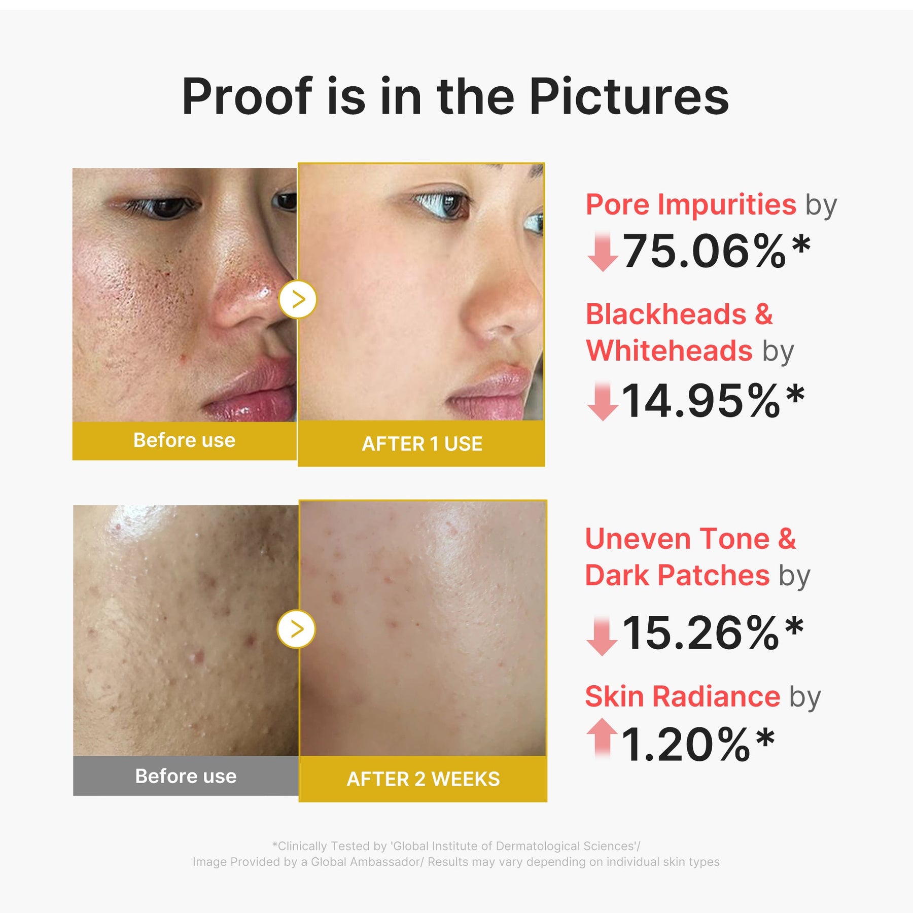 MEDICUBE Shot Peeling de Ácido Kójico e Cúrcuma