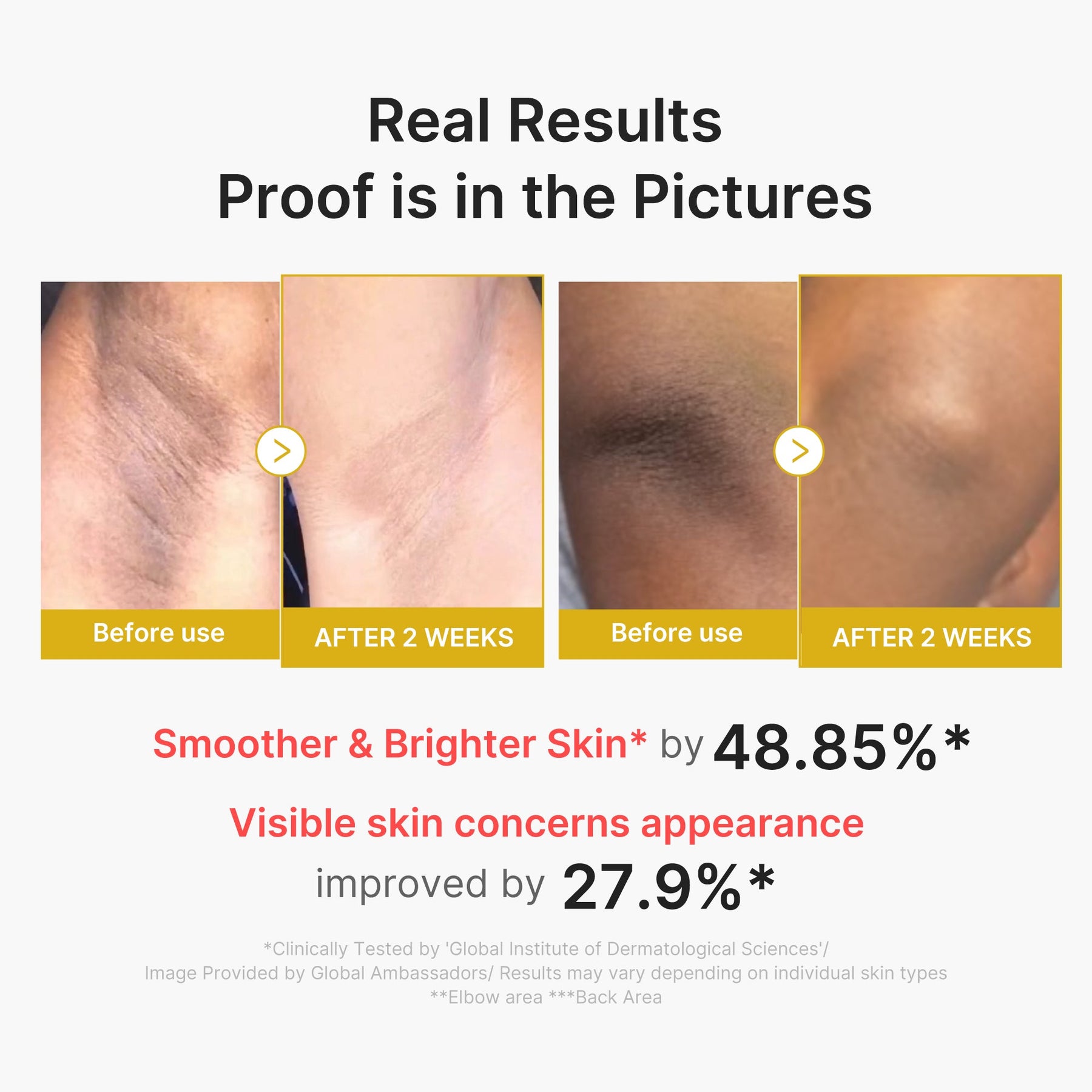 MEDICUBE Shot Peeling Corporal de Ácido Kójico e Cúrcuma