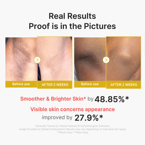 MEDICUBE Shot Peeling Corporal de Ácido Kójico e Cúrcuma
