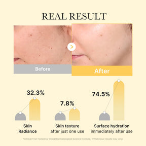 MEDICUBE Máscara em Gel Gold Jelly de Ácido Kójico e Cúrcuma