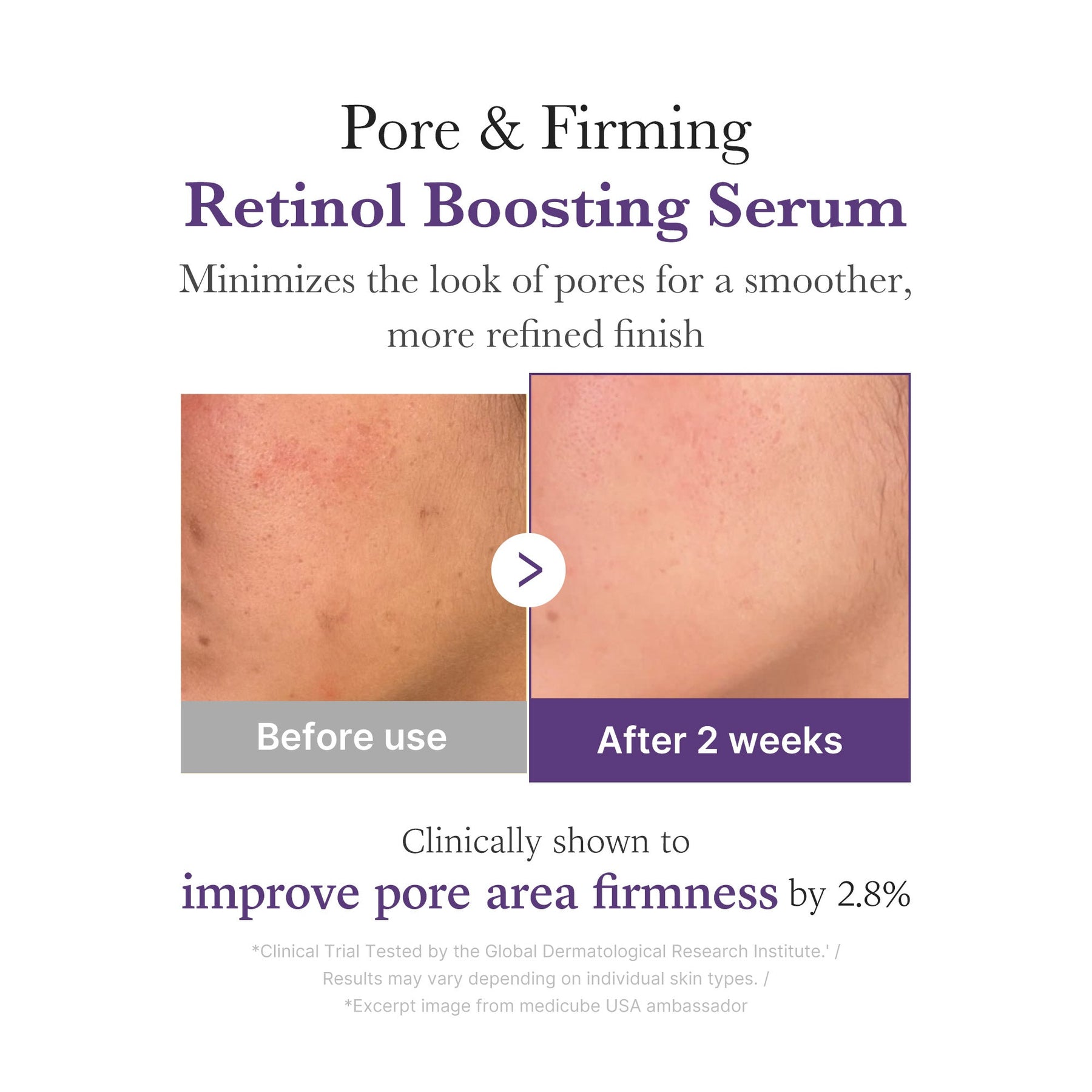 MEDICUBE Sérum Booster de Retinol e NMN