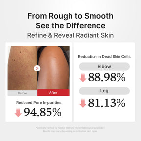MEDICUBE Shot Peeling Corporal de Arroz e Ácido Hipocloroso