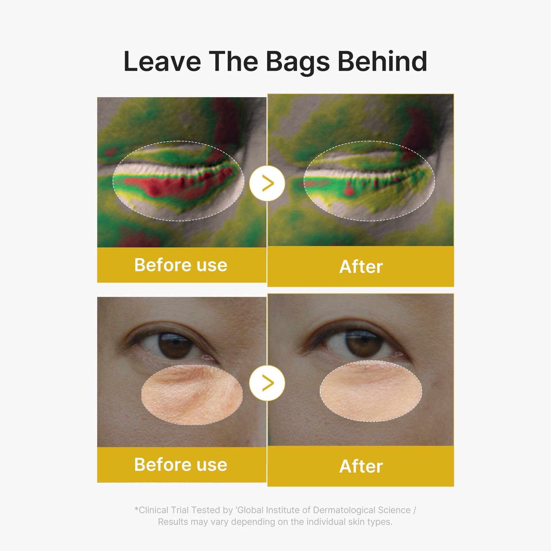 MEDICUBE Sérum Gel para Olhos de Ácido Kójico e Cúrcuma