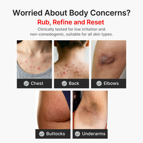 MEDICUBE Shot Peeling Corporal de Ácido Kójico e Cúrcuma