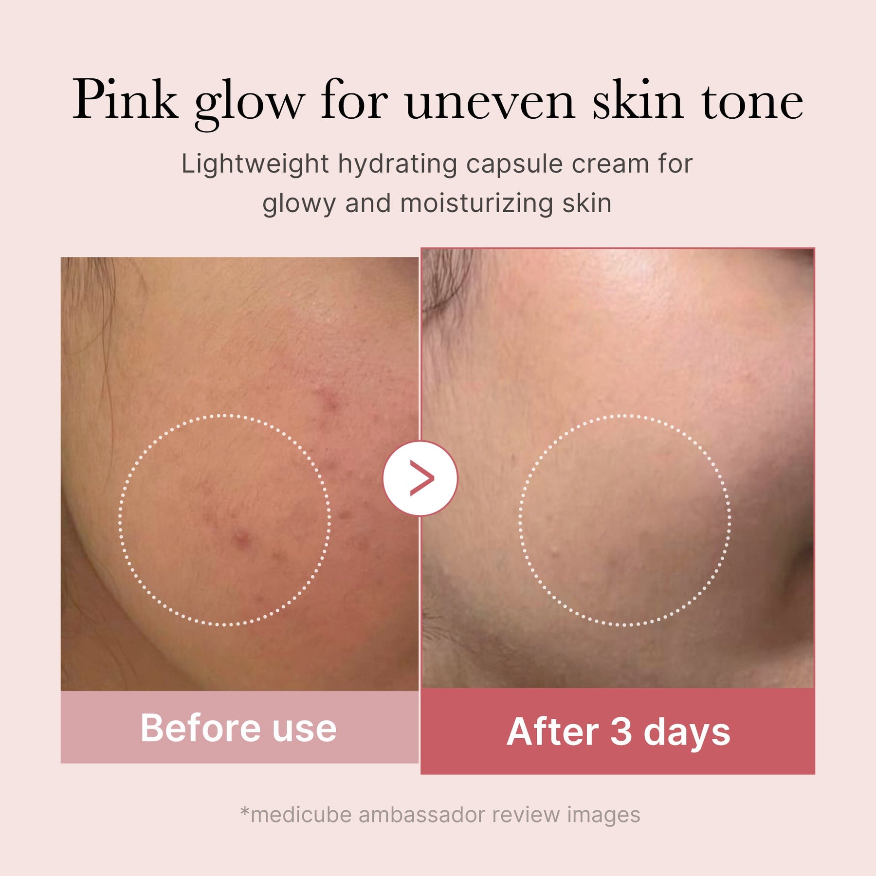 MEDICUBE Creme de Colágeno em Cápsulas PDRN Pink