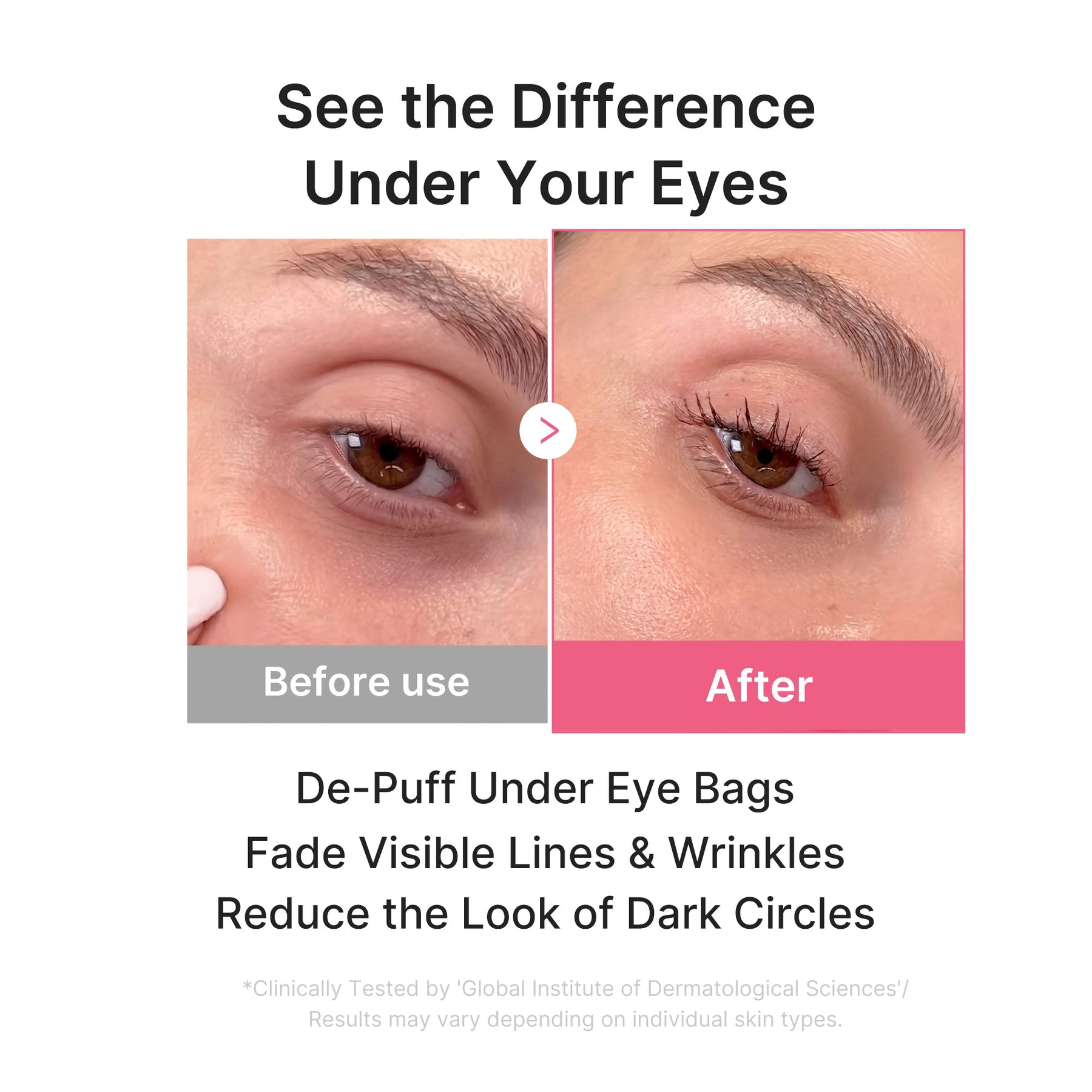 MEDICUBE Máscara em Gel para Olhos de Colágeno PDRN Pink
