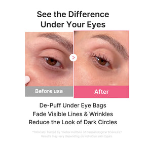 MEDICUBE Máscara em Gel para Olhos de Colágeno PDRN Pink