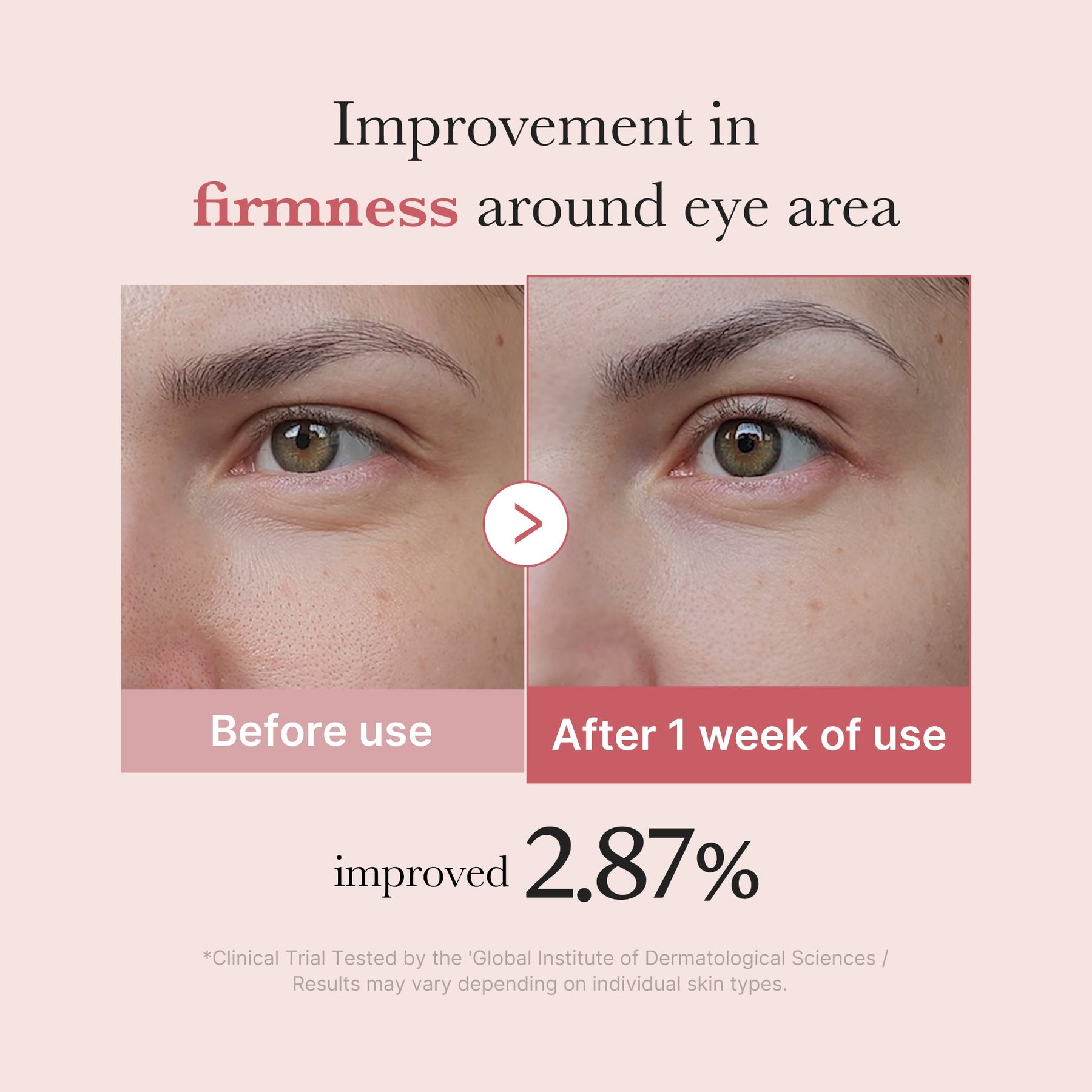 MEDICUBE Creme para Olhos de Peptídeo PDRN Pink