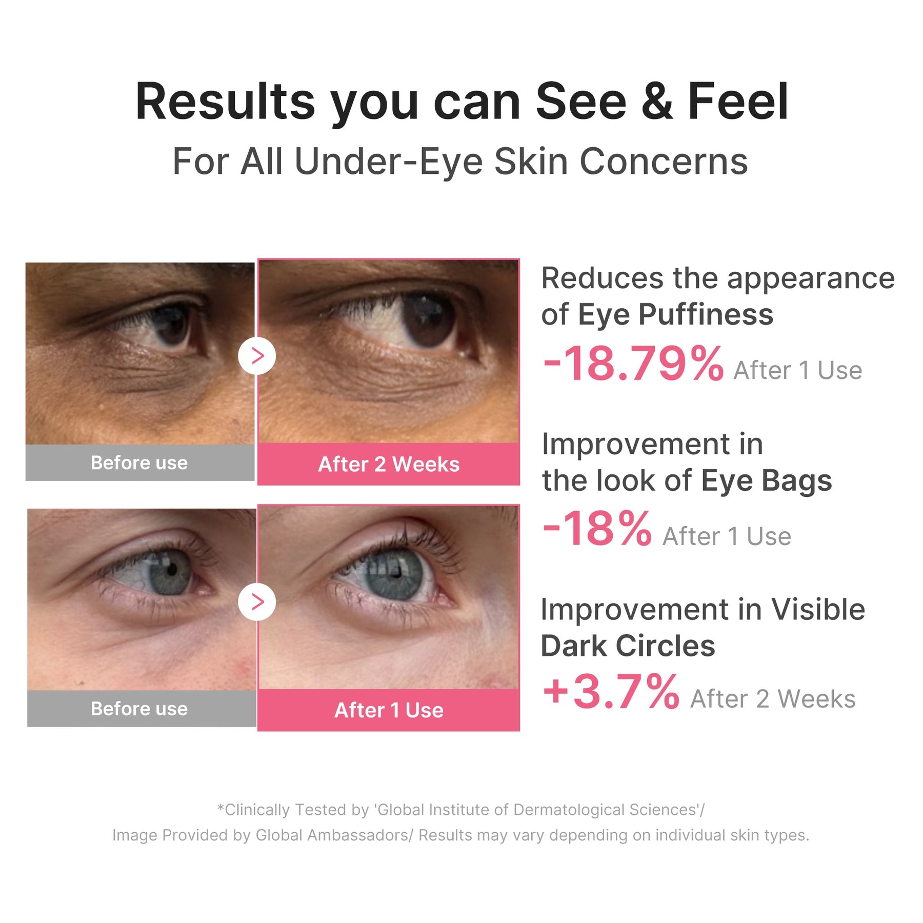 MEDICUBE Patch para Olhos de PDRN, Cafeína e Colágeno