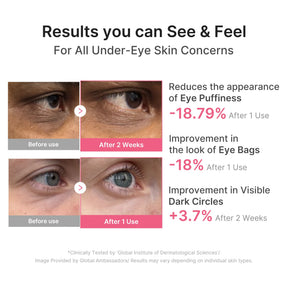 MEDICUBE Patch para Olhos de PDRN, Cafeína e Colágeno