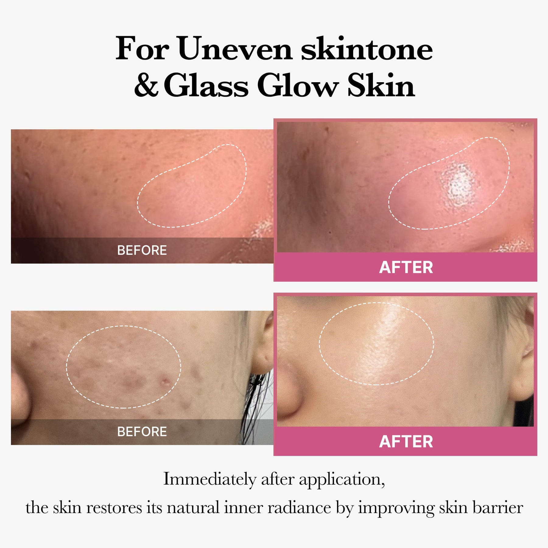 MEDICUBE [Tati's Exclusive] All About Glow Set