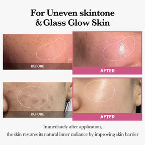 MEDICUBE [Tati's Exclusive] All About Glow Set